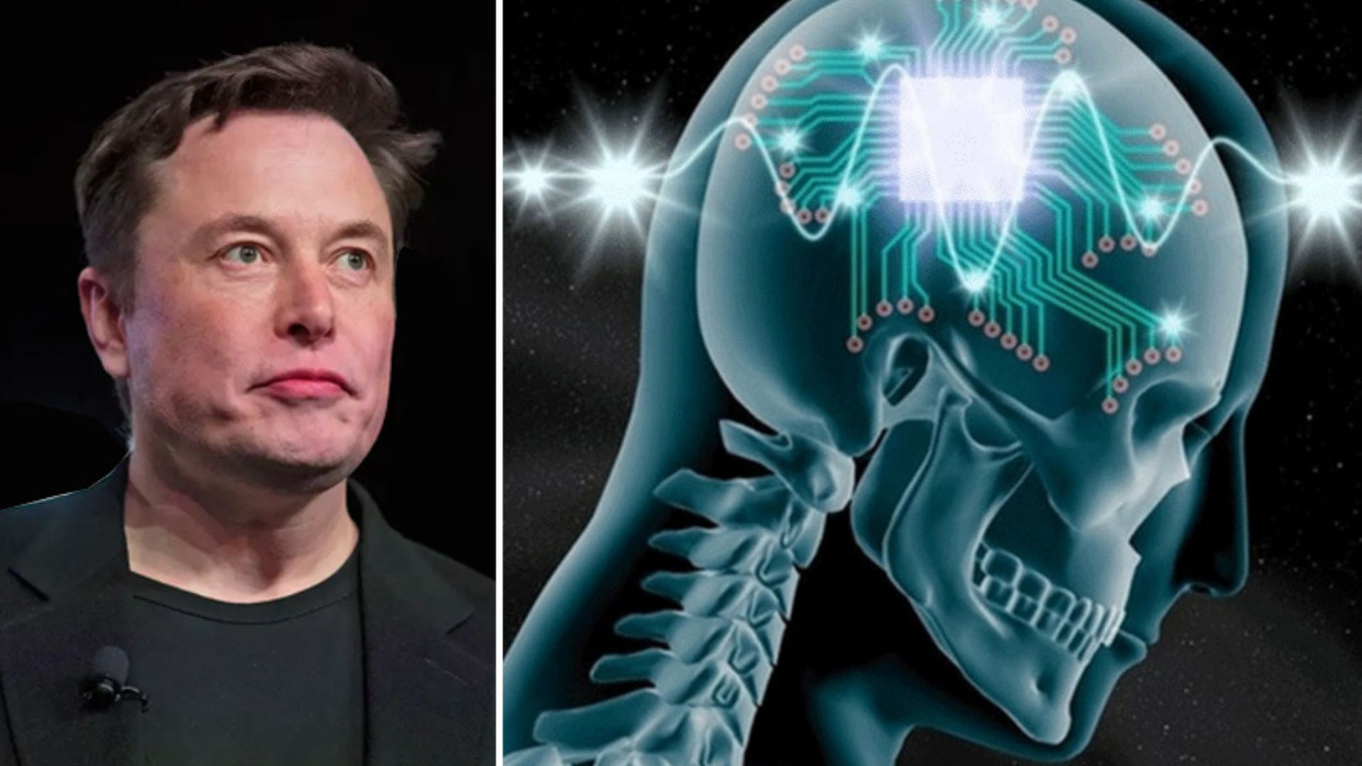 Is It Possible To Hack The Neuralink chip That Is In Mind